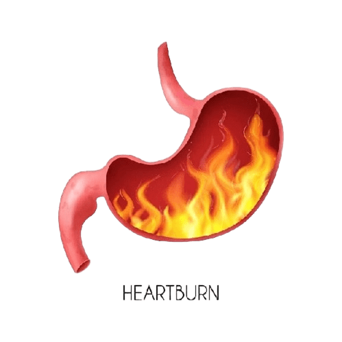 Top Gastroenterologist India for Heartburn