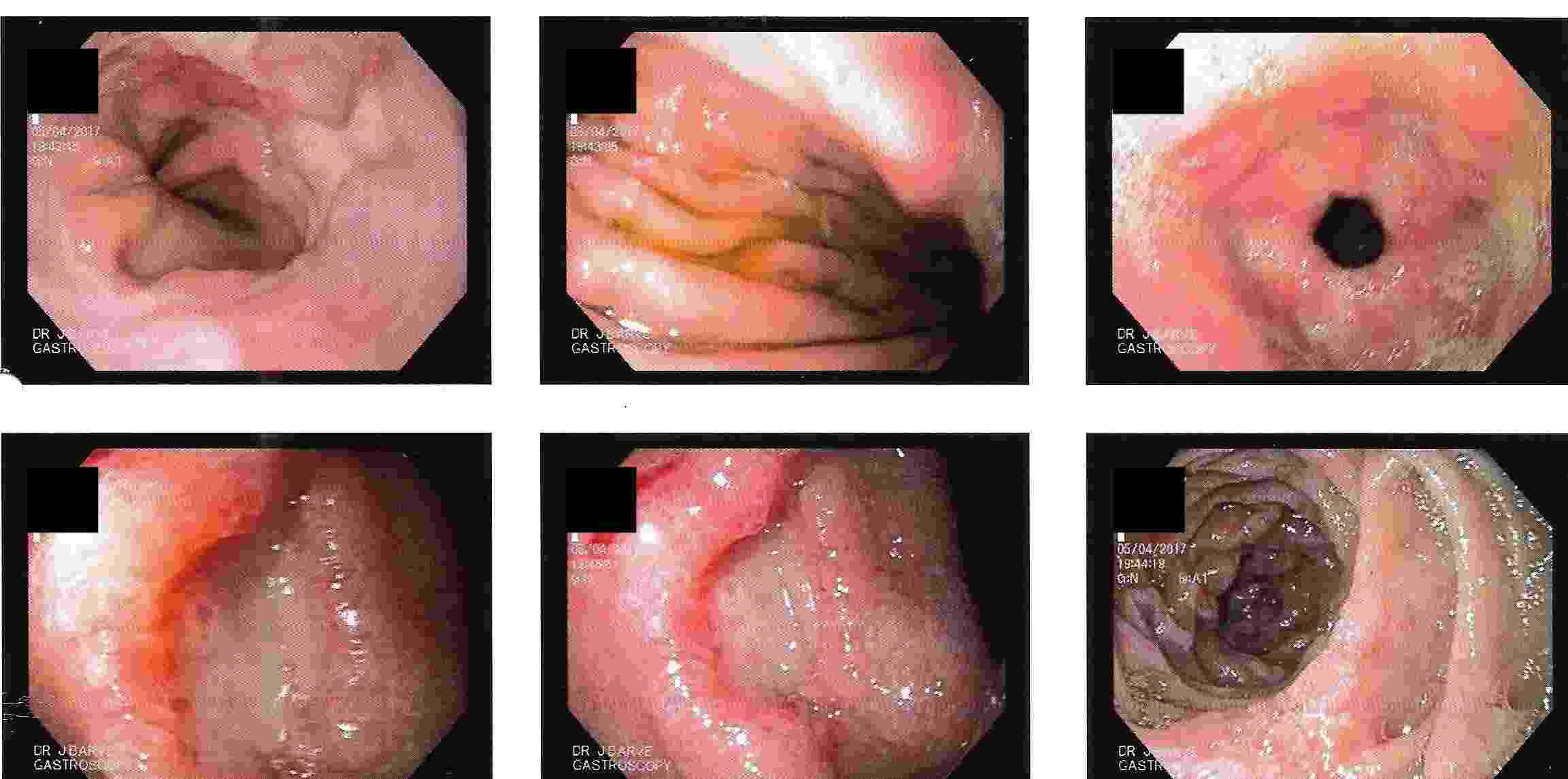 Top Gastroenterologist in India